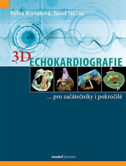 Obrázek produktu: 3D Echokardiografie