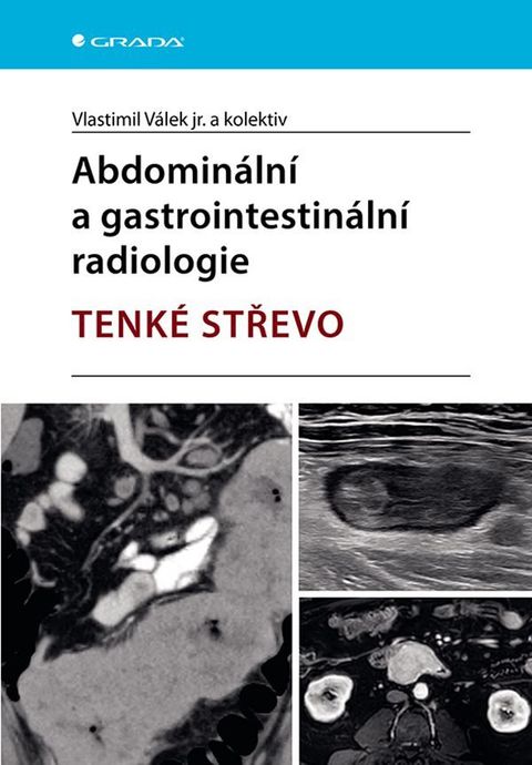Obrázek produktu: Abdominální a gastrointestinální radiologie - Tenké střevo