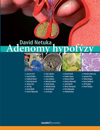 Obrázek produktu: Adenomy hypofýzy