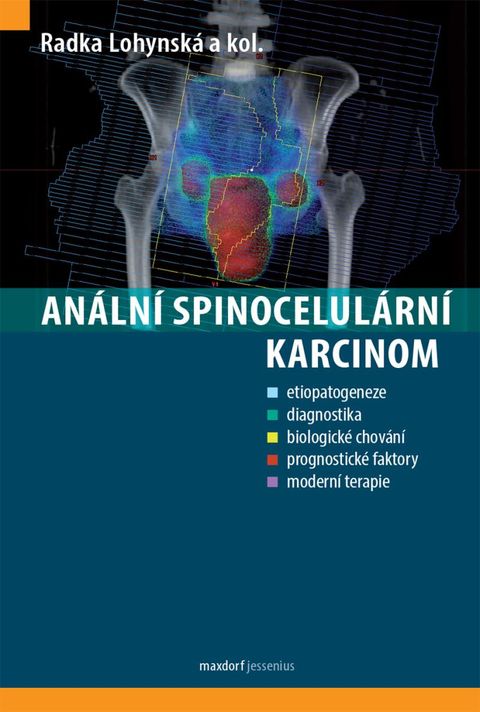 Obrázek produktu: Anální spinocelulární karcinom