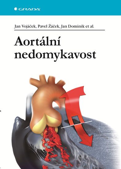 Obrázek produktu: Aortální nedomykavost