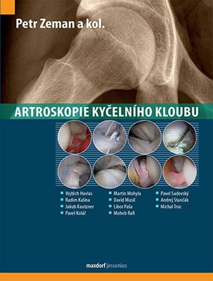 Obrázek produktu: Artroskopie kyčelního kloubu
