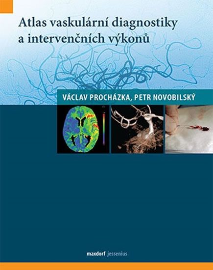 Obrázek produktu: Atlas vaskulární diagnostiky a intervenčních výkonů