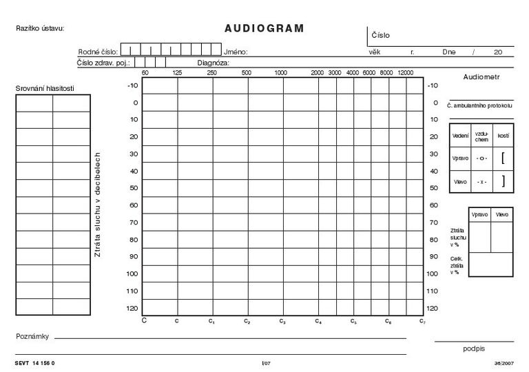 Audiogram