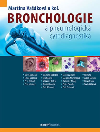Obrázek produktu: Bronchologie a pneumologická cytodiagnostika