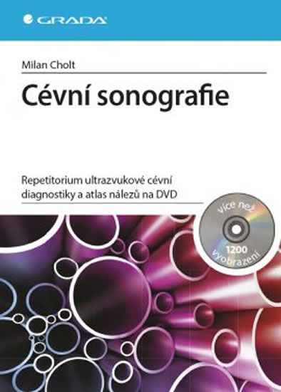 Obrázek produktu: Cévní sonografie - repetitorium ultrazvukové cévní diagnostiky a atlas nálezů na DVD
