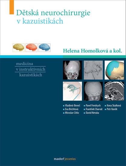 Obrázek produktu: Dětská neurochirurgie v kazuistikách