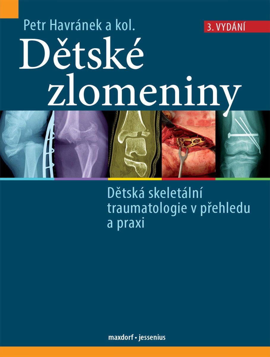 Dětské zlomeniny - Dětská skeletální traumatologie v přehledu a praxi