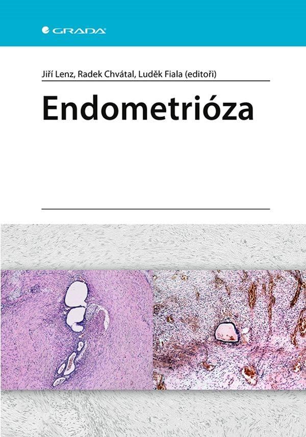 Endometrióza GRADA Publishing, a. s.