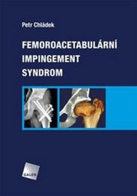 Obrázek produktu: Femoroacetabulární impingement syndrom