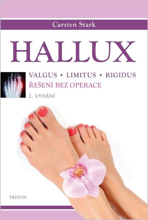 Obrázek produktu: Hallux - Řešení bez operace
