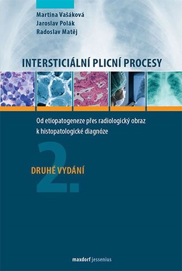 Levně Intersticiální plicní procesy - Od etiopatogeneze přes radiologický obraz k histopatologické diagnóz