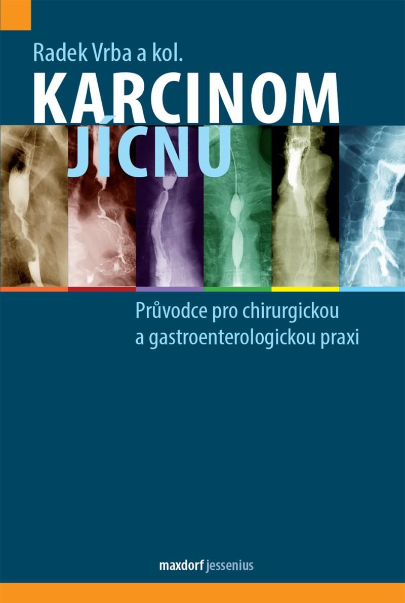 Karcinom jícnu - Průvodce pro chirurgickou a gastroenterologickou praxi