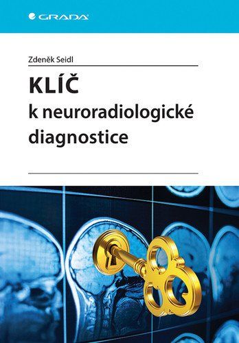Obrázek produktu: Klíč k neuroradiologické diagnostice