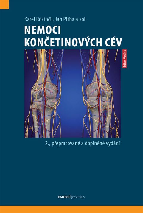 Obrázek produktu: Nemoci končetinových cév