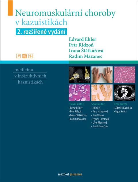 Obrázek produktu: Neuromuskulární choroby v kazuistikách