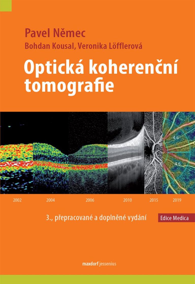 Levně Optická koherenční tomografie