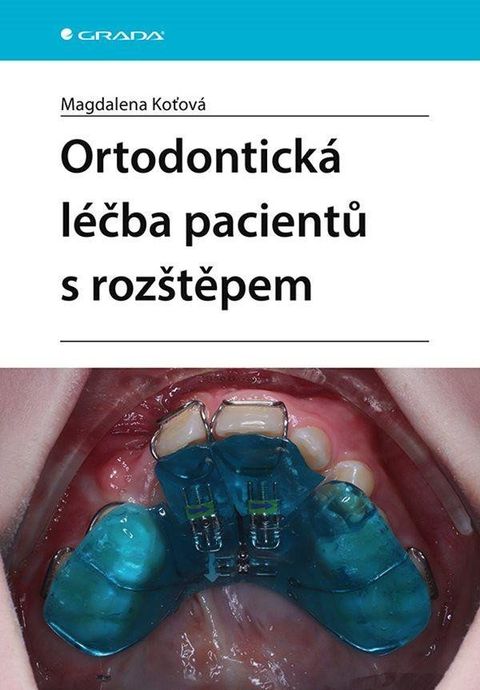 Obrázek produktu: Ortodontická léčba pacientů s rozštěpem