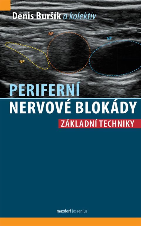 Obrázek produktu: Periferní nervové blokády - Základní techniky