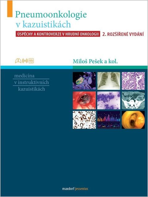 Obrázek produktu: Pneumoonkologie v kazuistikách - Úspěchy a kontroverze v hrudní chirurgii
