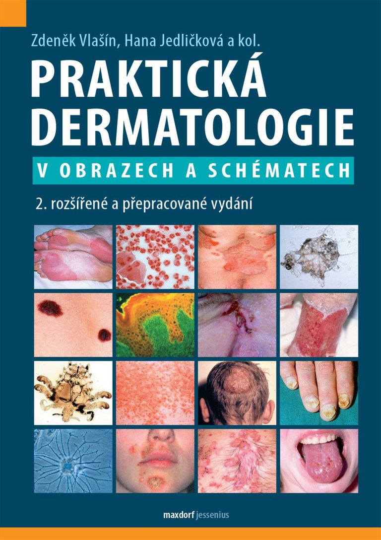 Levně Praktická dermatologie v obrazech a schématech