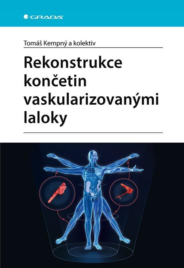 Rekonstrukce končetin vaskularizovanými laloky - Tomáš Kempný, kol.