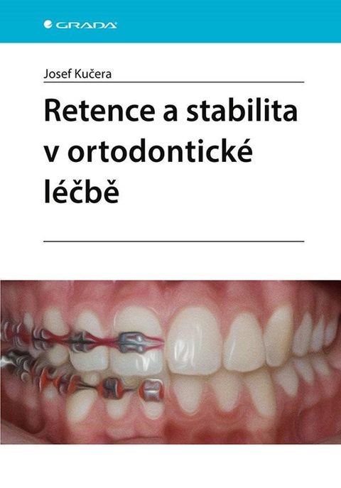 Obrázek produktu: Retence a stabilita v ortodontické léčbě