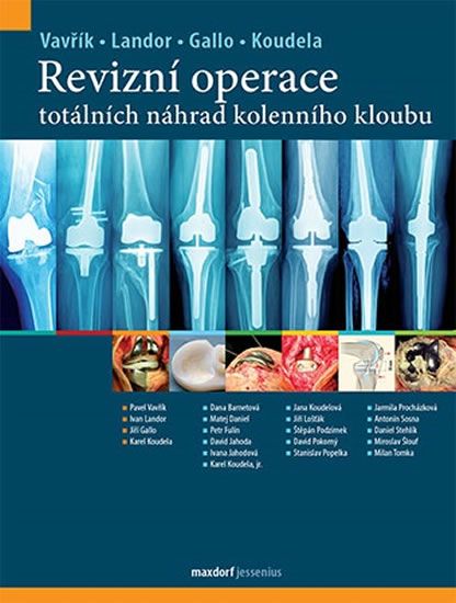 Obrázek produktu: Revizní operace totálních náhrad kolenního kloubu