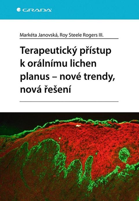 Obrázek produktu: Terapeutický přístup k orálnímu lichen planus - nové trendy, nová řešení