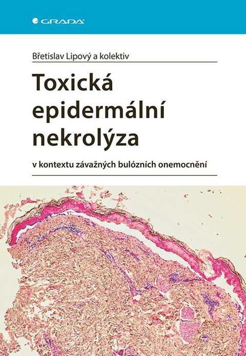 Obrázek produktu: Toxická epidermální nekrolýza v kontextu závažných bulózních onemocnění