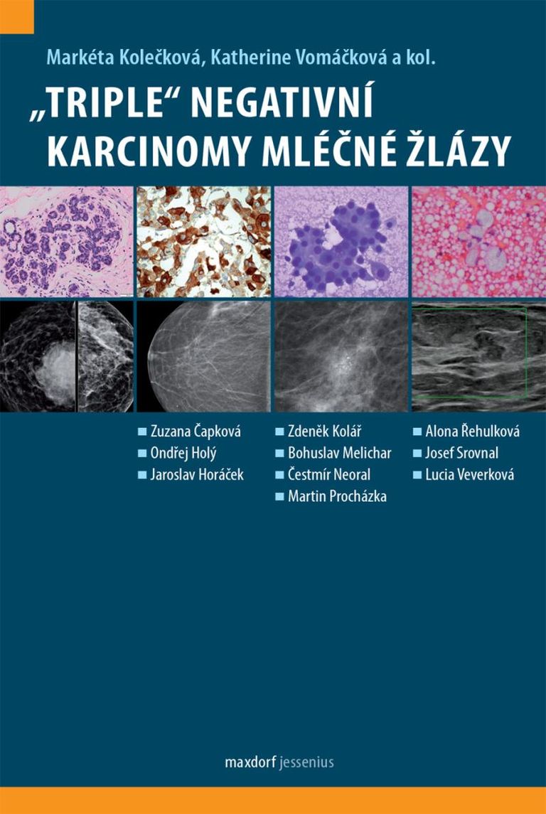 „Triple“ negativní karcinomy mléčné žlázy - Markéta Kolečková