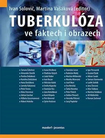 Obrázek produktu: Tuberkulóza ve faktech i obrazech
