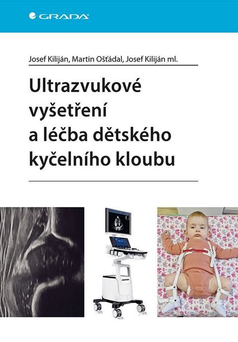 Obrázek produktu: Ultrazvukové vyšetření a léčba dětského kyčelního kloubu
