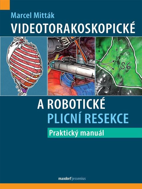 Obrázek produktu: Videotorakoskopické a robotické plicní resekce