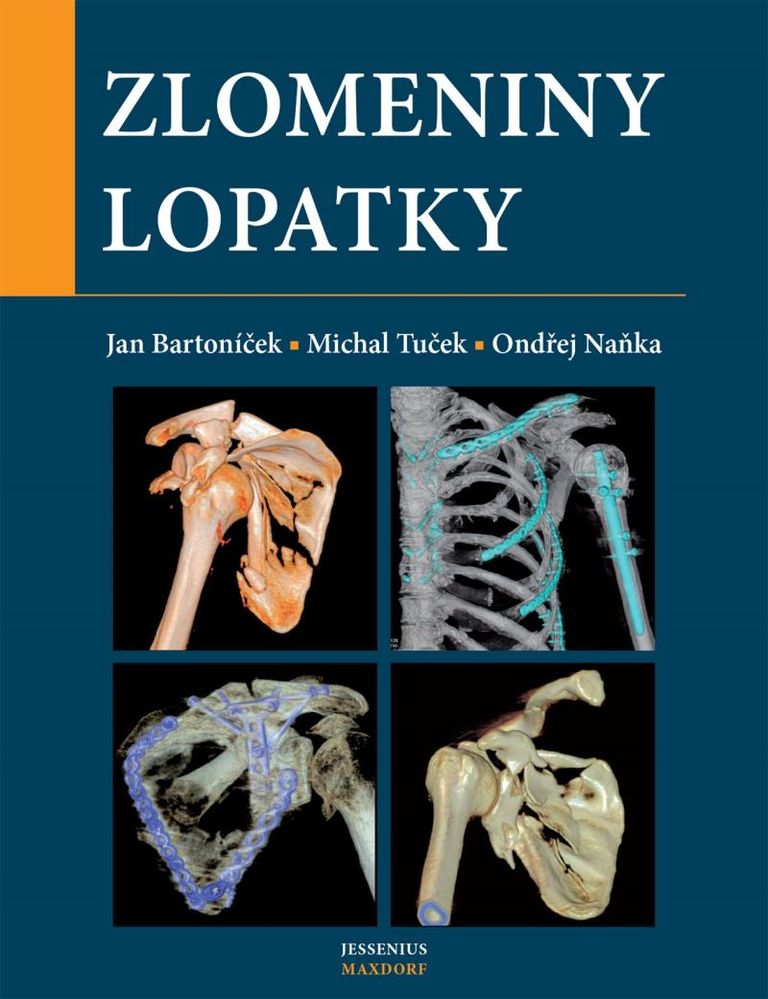 Zlomeniny lopatky - Michal Tuček, Ondřej Naňka, Jan Bartoníček